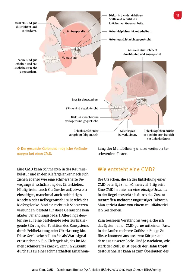 Abbildung 7 von CMD - Craniomandibuläre Dysfunktion