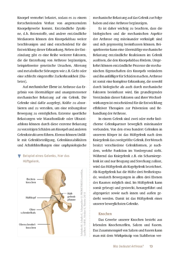 Abbildung 12 von Expertenwissen: Arthrose