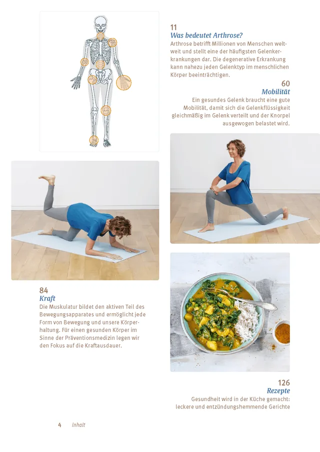 Abbildung 3 von Expertenwissen: Arthrose